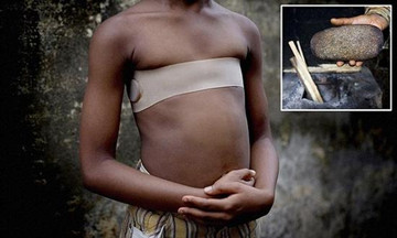 非洲少女把胸部熨平防性侵 母亲亲自动手